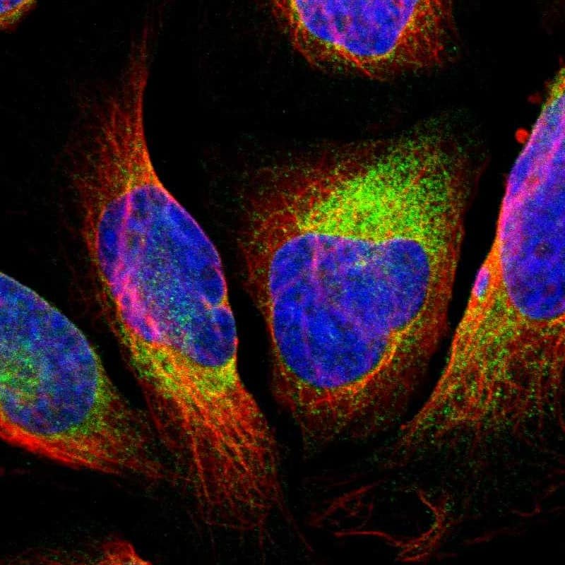 Staining of human cell line U-2 OS shows localization to endoplasmic reticulum.