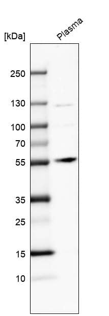 Analysis in human plasma.