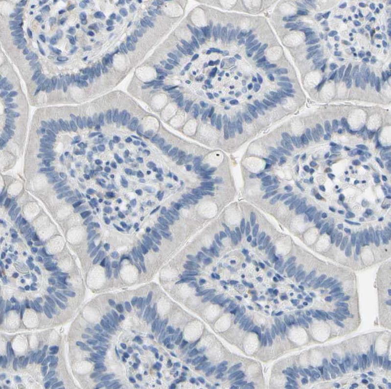 Staining of small intestine shows no positivity in glandular cells as expected.