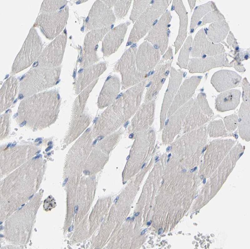 Staining of human skeletal muscle shows no expression in myocytes as expected.