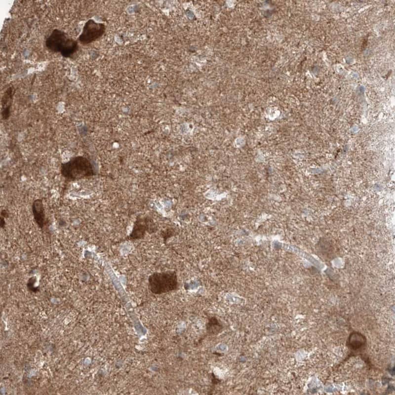 Staining of human caudate shows strong positivity in neuronal cells.