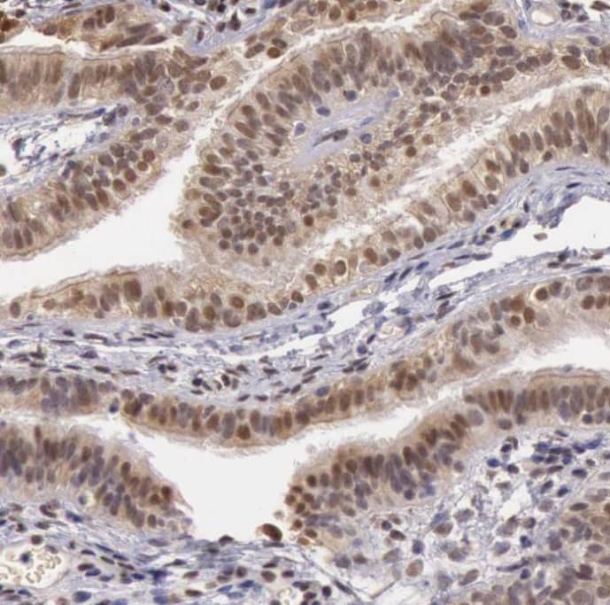 Staining of human fallopian tube shows moderate nuclear positivity in glandular cells.