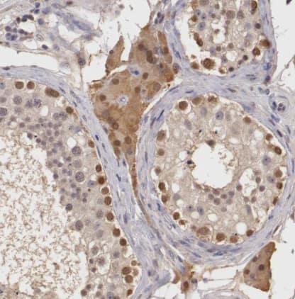  Staining of human testis shows moderate nuclear and cytoplasmic positivity in cells in seminiferous ducts and Leydig cells.