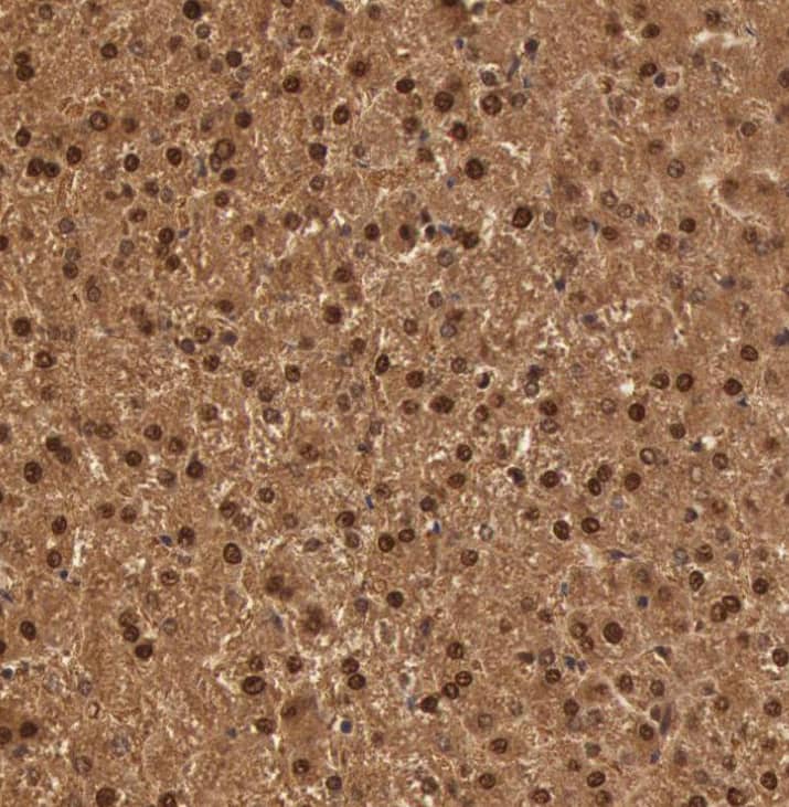 Staining of human liver shows strong nuclear and cytoplasmic positivity in hepatocytes.