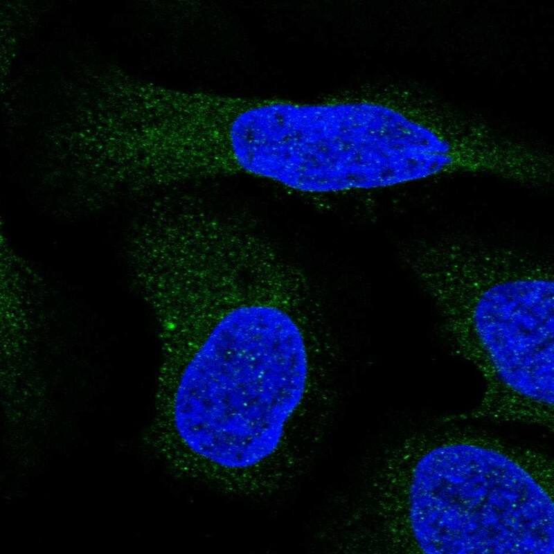 Immunocytochemistry/ Immunofluorescence ALG9 Antibody - BSA Free