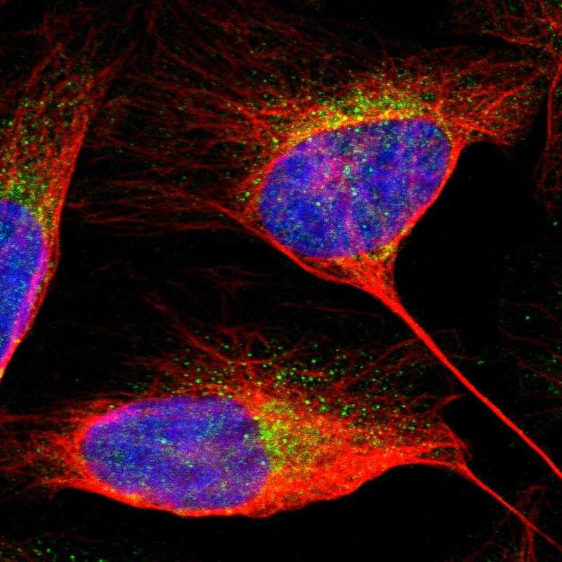 Staining of human cell line U-2 OS shows localization to cytosol.