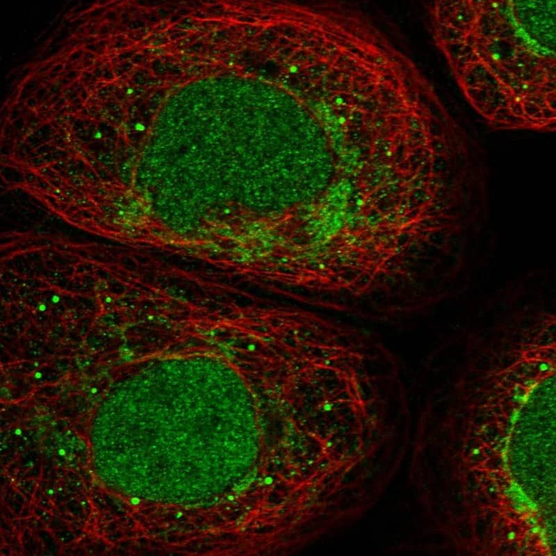Staining of human cell line A-431 shows localization to nucleoplasm, mitochondria & vesicles.