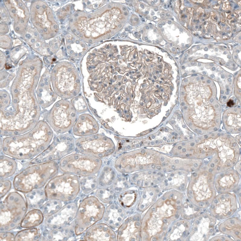 Staining of human kidney shows weak membranous positivity in cells in glomeruli.