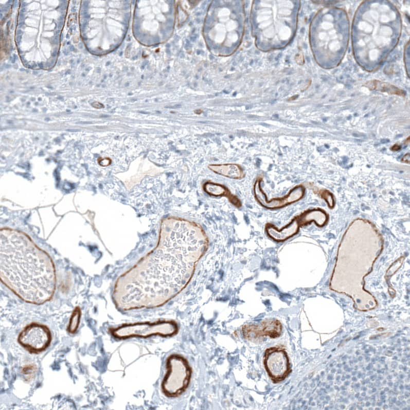 Staining of human colon shows strong membranous positivity in endothelial cells.