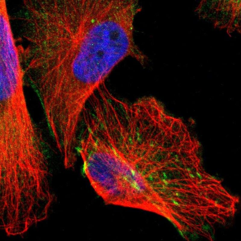 Staining of human cell line U-251 MG shows positivity in cytoplasm, actin filaments & focal adhesion sites.