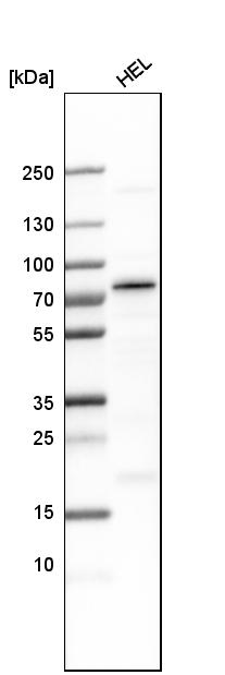 Analysis in human cell line HEL.