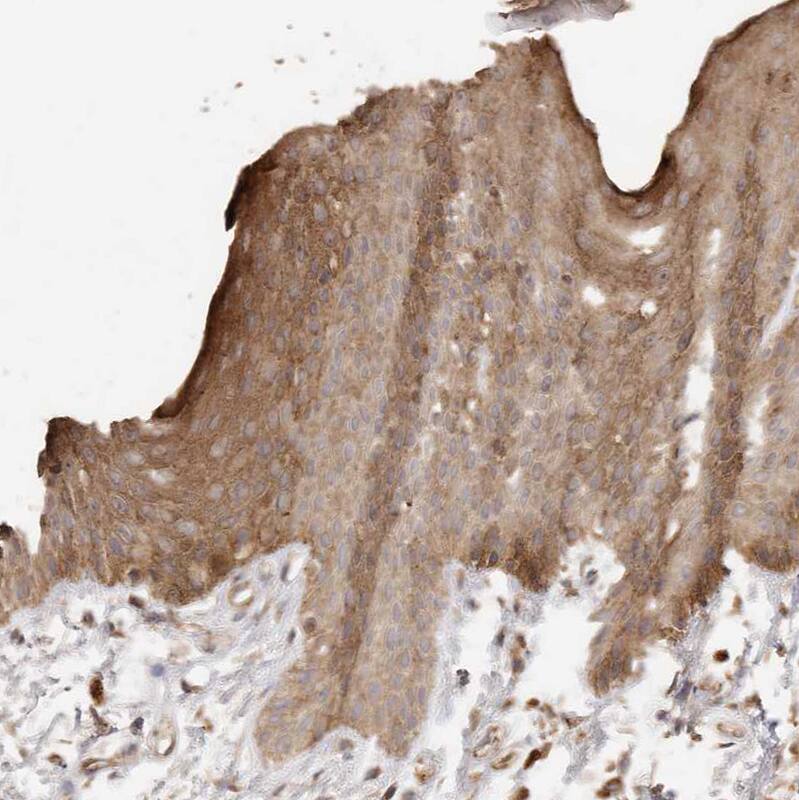 Staining of human Skin shows moderate cytoplasmic positivity in squamous epithelial cells.
