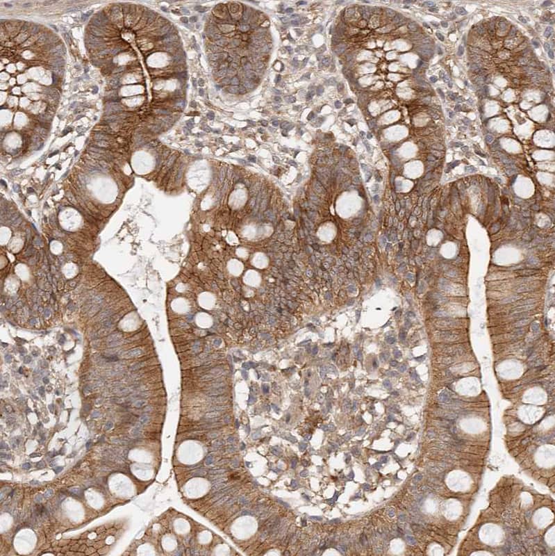 Staining of human Small intestine shows moderate cytoplasmic positivity in glandular cells.