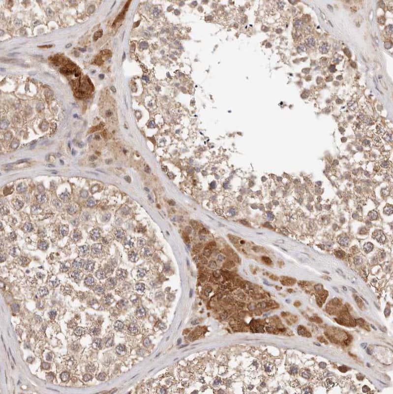 Staining of human Testis shows moderate cytoplasmic positivity in Leydig cells and cells in seminiferous ducts.