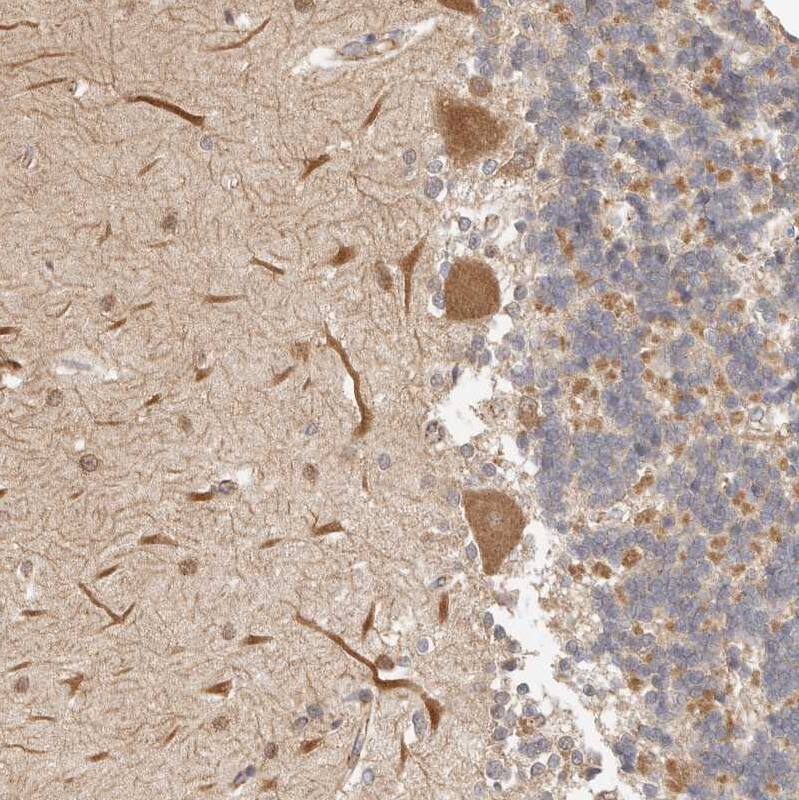 Staining of human Cerebellum shows moderate cytoplasmic positivity in Purkinje cells.