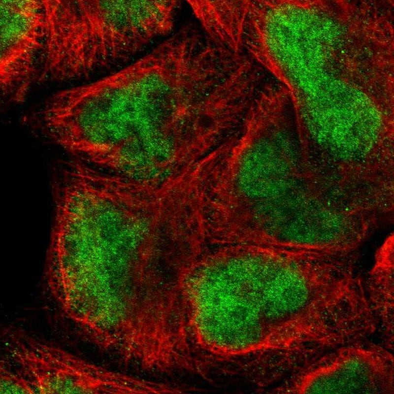 Immunocytochemistry/ Immunofluorescence AF10 Antibody - BSA Free
