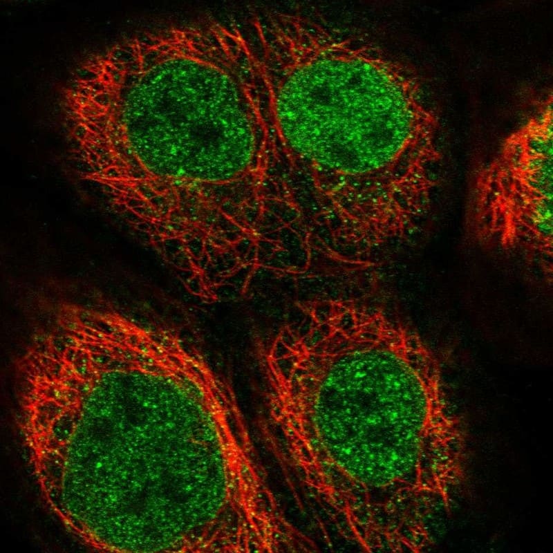 Immunocytochemistry/ Immunofluorescence EOGT/AER61 Antibody - BSA Free