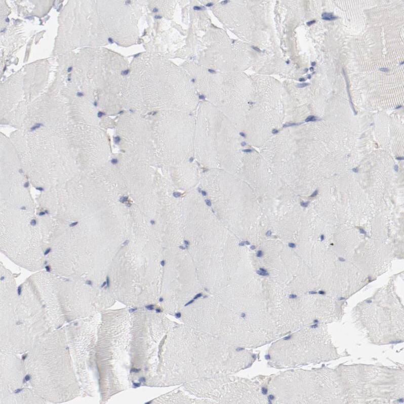 Immunohistochemistry-Paraffin beta-2 Adrenergic R/ADRB2 Antibody - BSA Free
