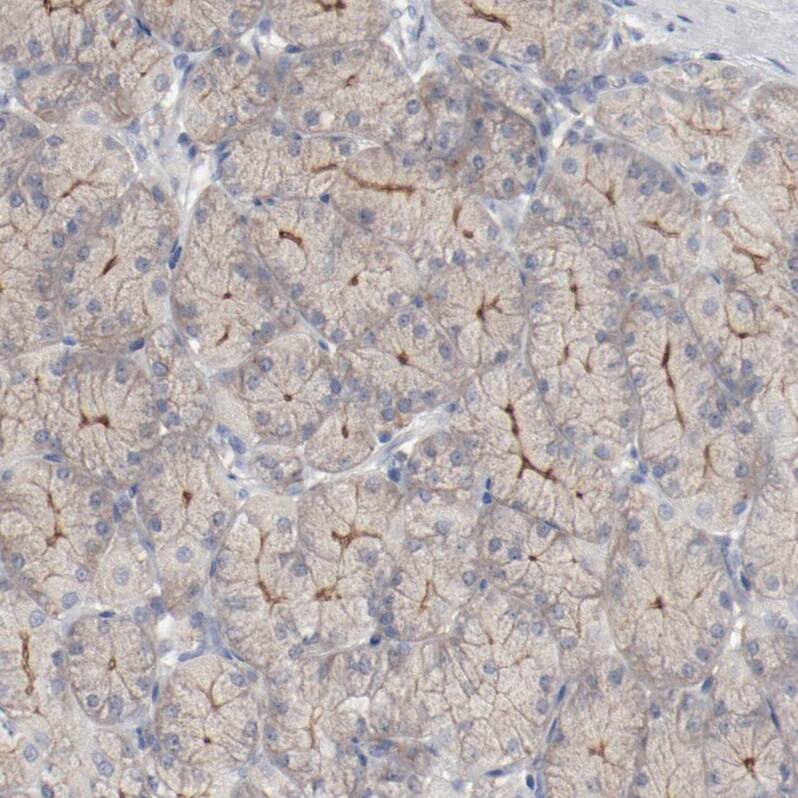 Immunohistochemistry-Paraffin beta-2 Adrenergic R/ADRB2 Antibody - BSA Free