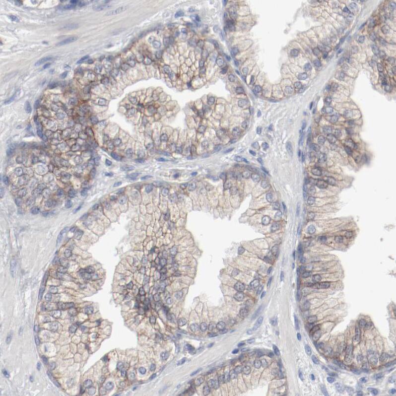 Immunohistochemistry-Paraffin beta-2 Adrenergic R/ADRB2 Antibody - BSA Free