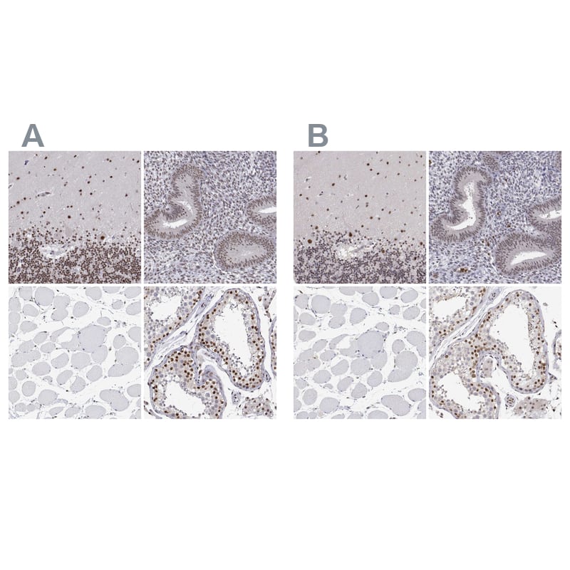 Staining of human cerebellum, endometrium, skeletal muscle and testis using NBP1-90242 (A) shows similar protein distribution across tissues to independent antibody NBP3-05523 (B).