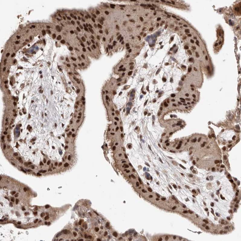 Staining of human placenta shows  strong nuclear positivity in trophoblastic cells.