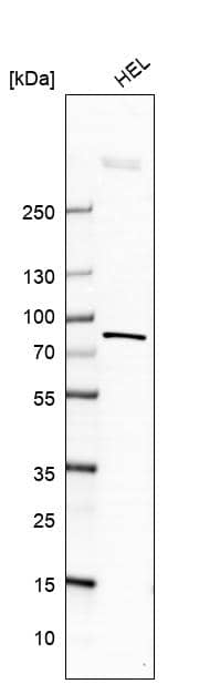 Analysis in human cell line HEL.