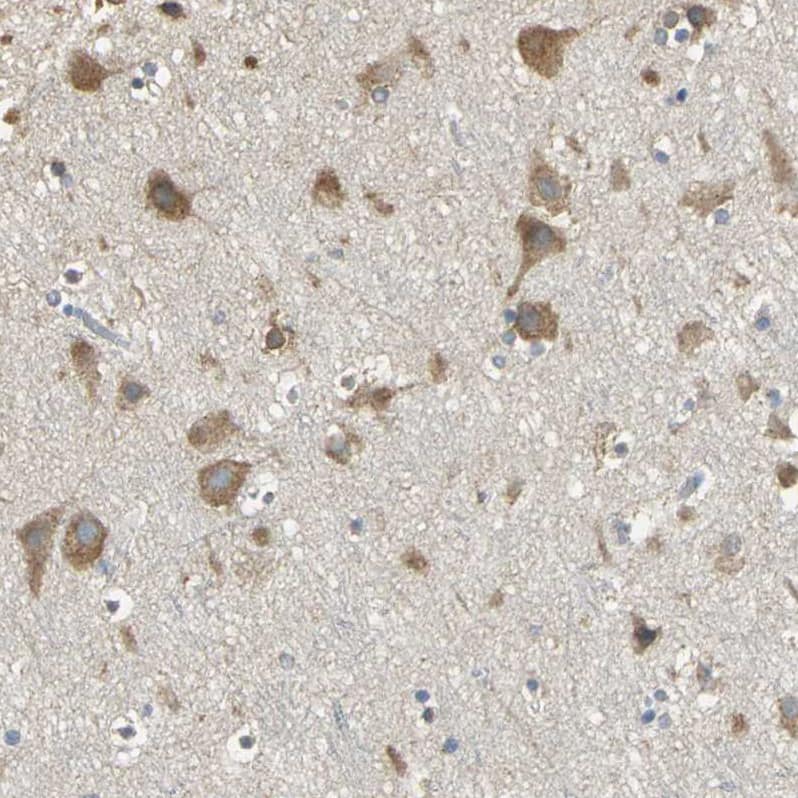 Staining of human cerebral cortex shows moderate granular cytoplasmic positivity in neurons.