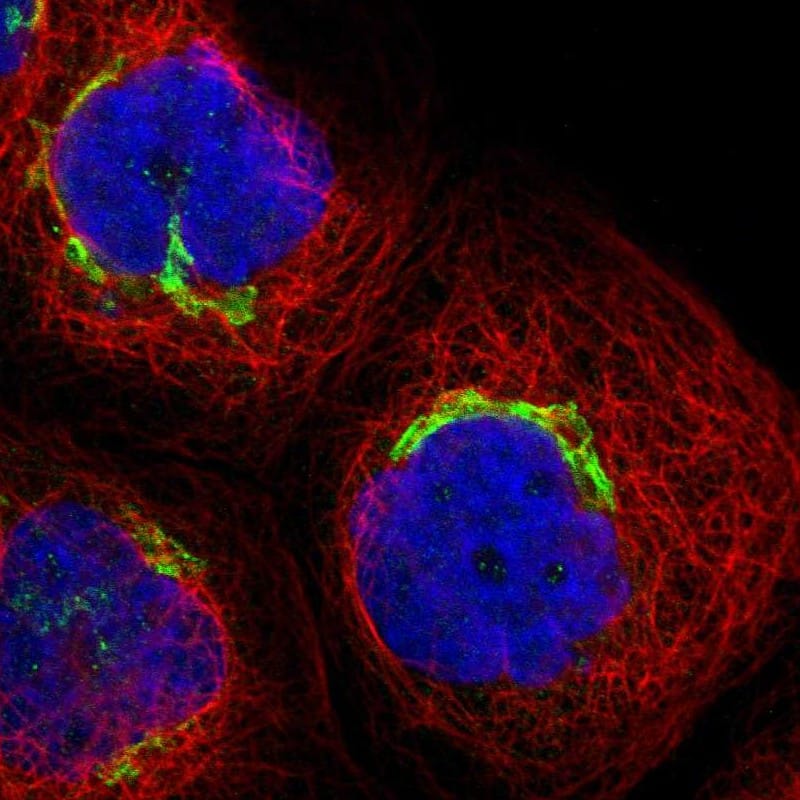 Staining of human cell line A-431 shows localization to the Golgi apparatus.
