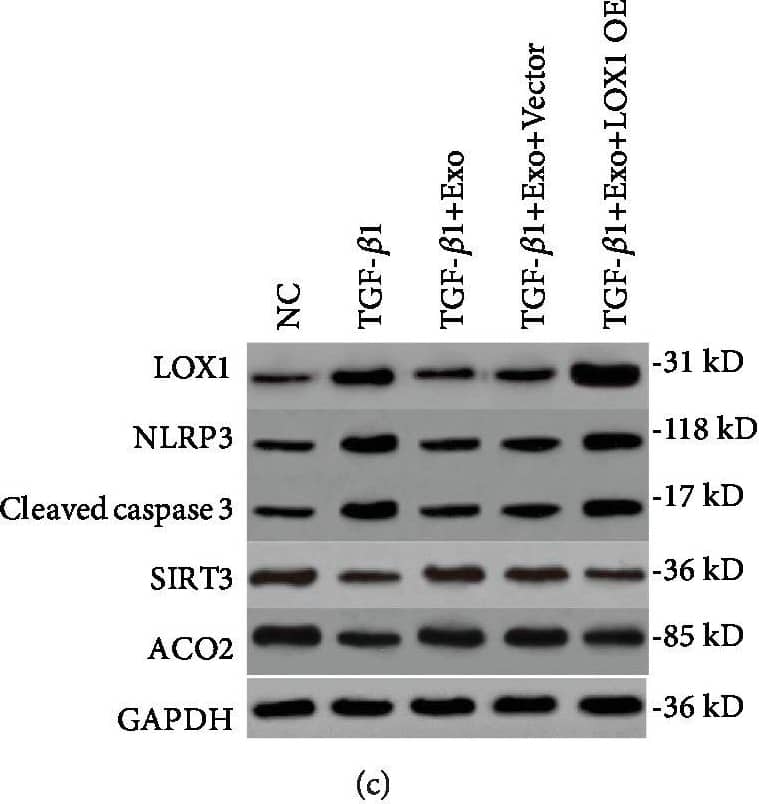 Western Blot: Aconitase 2 Antibody [NBP1-90264] - The regulation mechanism of LOX1 on alveolar epithelial cell apoptosis & fibrosis. (a) Cells were transfected with a LOX1 overexpression plasmid & control vector. ROS levels were determined by DCFH-DA assay in MLE-12 cells treated by TGF-beta 1, TGF-beta 1 plus exosome, TGF-beta 1 plus exosome & vector, & TGF-beta 1 plus exosome & LOX1 overexpression plasmid (n = 3). (b) Detection of cellular mtDNA/18sRNA in each of the above cell groups (n = 3). (c) The expression of LOX1, caspase 3, mtDNA damage markers SIRT3 & ACO2, & NLRP3 was measured by western blotting in each of the above cell groups. (d) The expression of the same signal cascades including LOX1, caspase 3, SIRT3, ACO2, & NLRP3 was confirmed in an animal model with pulmonary fibrosis by western blot assay. Data is shown as the means ± SD, n ≥ 3. ∗∗p < 0.01. Image collected & cropped by CiteAb from the following publication (//pubmed.ncbi.nlm.nih.gov/31949877), licensed under a CC-BY license. Not internally tested by Novus Biologicals.