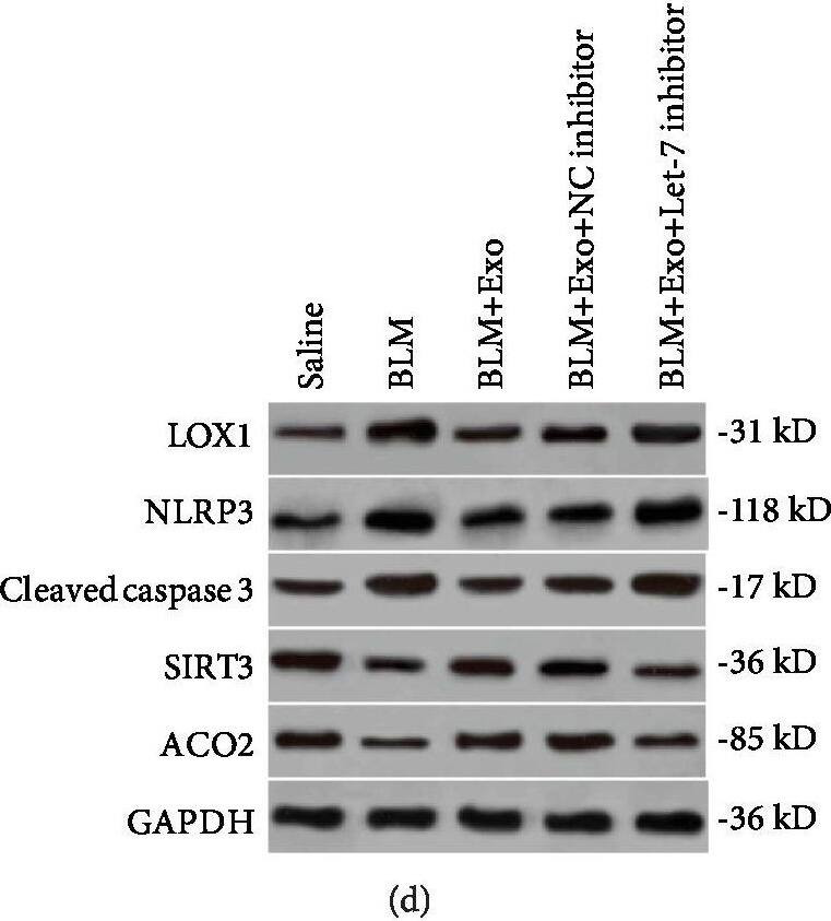 Western Blot: Aconitase 2 Antibody [NBP1-90264] - The regulation mechanism of LOX1 on alveolar epithelial cell apoptosis & fibrosis. (a) Cells were transfected with a LOX1 overexpression plasmid & control vector. ROS levels were determined by DCFH-DA assay in MLE-12 cells treated by TGF-beta 1, TGF-beta 1 plus exosome, TGF-beta 1 plus exosome & vector, & TGF-beta 1 plus exosome & LOX1 overexpression plasmid (n = 3). (b) Detection of cellular mtDNA/18sRNA in each of the above cell groups (n = 3). (c) The expression of LOX1, caspase 3, mtDNA damage markers SIRT3 & ACO2, & NLRP3 was measured by western blotting in each of the above cell groups. (d) The expression of the same signal cascades including LOX1, caspase 3, SIRT3, ACO2, & NLRP3 was confirmed in an animal model with pulmonary fibrosis by western blot assay. Data is shown as the means ± SD, n ≥ 3. ∗∗p < 0.01. Image collected & cropped by CiteAb from the following publication (//pubmed.ncbi.nlm.nih.gov/31949877), licensed under a CC-BY license. Not internally tested by Novus Biologicals.