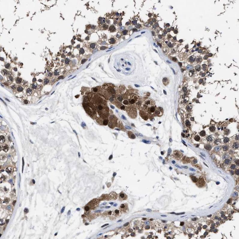Staining of human testis shows strong cytoplasmic positivity in Leydig cells.