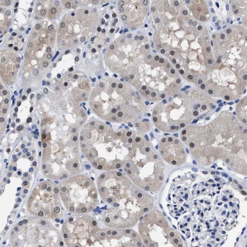 Staining of human kidney shows weak cytoplasmic positivity in cells in tubules.