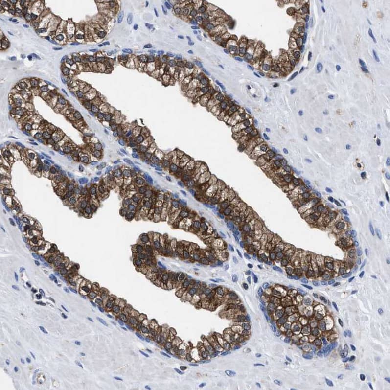 Staining of human prostate shows moderate cytoplasmic positivity in glandular cells.