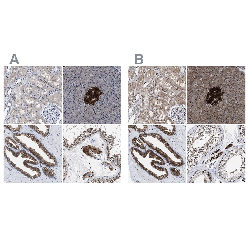 <b>Orthogonal Strategies Validation. </b>Staining of human kidney, pancreas, prostate and testis HPA022959 (A) shows similar protein distribution across tissues to independent antibody HPA022434 (B).
