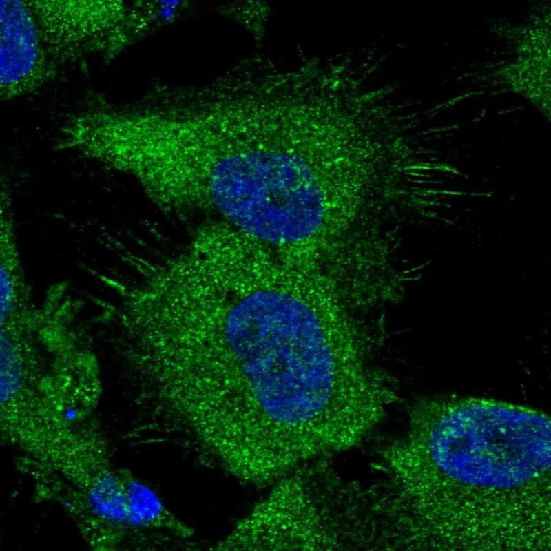 Staining of human cell line U-251 MG shows localization to plasma membrane & cytosol.