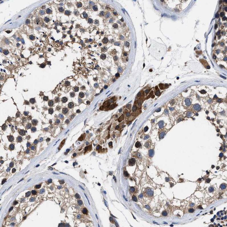 Staining of human testis shows strong cytoplasmic positivity in Leydig cells.