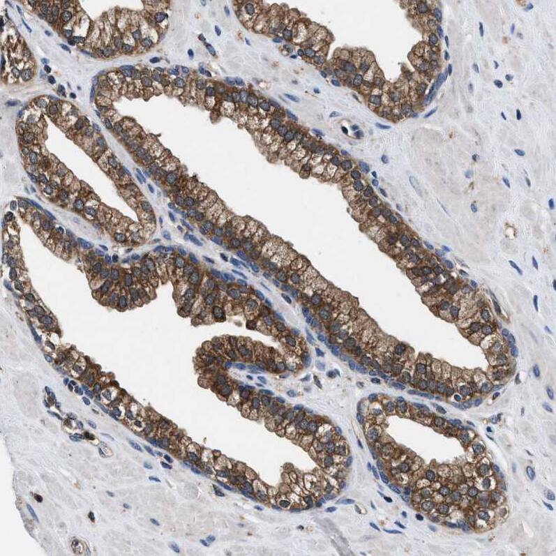 Staining of human prostate shows strong cytoplasmic positivity in glandular cells.