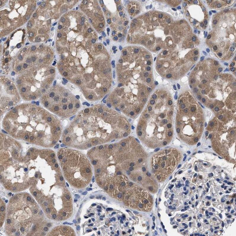 Staining of human kidney shows moderate cytoplasmic positivity in cells in tubules.