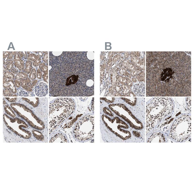 Staining of human kidney, pancreas, prostate and testis HPA022953 (A) shows similar protein distribution across tissues to independent antibody HPA022434 (B).