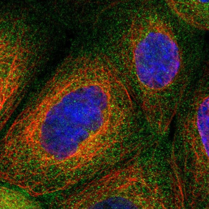 Staining of human cell line A-431 shows localization to cytosol.