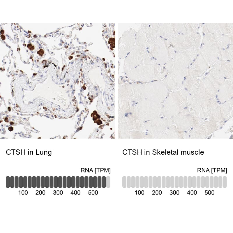 <b>Orthogonal Strategies Validation. </b>Analysis in human lung and skeletal muscle tissues using Anti-CTSH antibody. Corresponding CTSH RNA-seq data are presented for the same tissues.