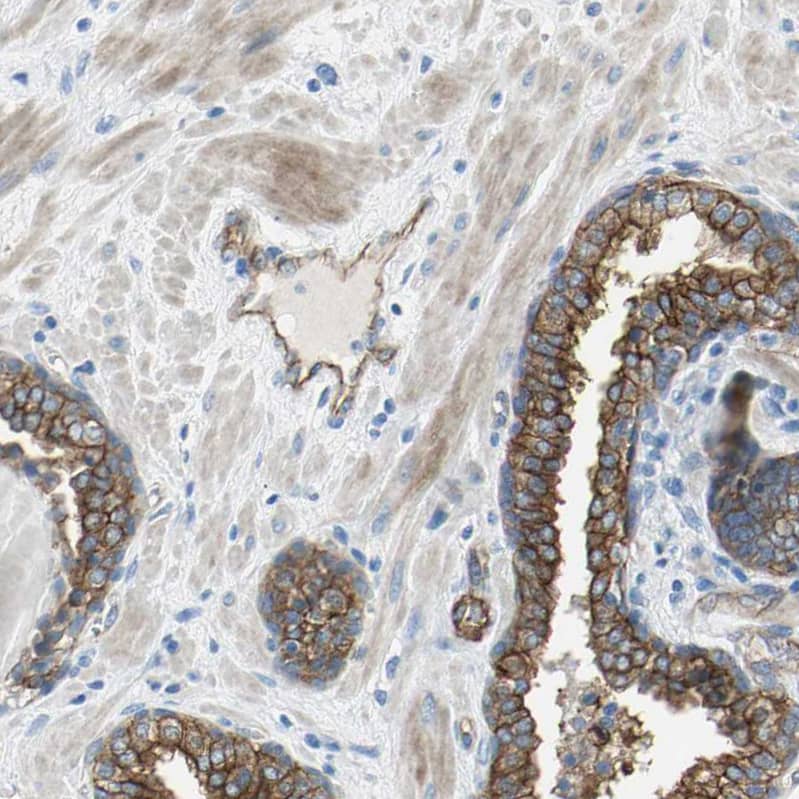 Immunohistochemistry Filamin B Antibody - BSA Free