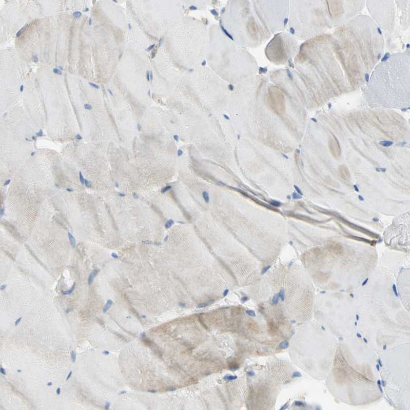 Immunohistochemistry Filamin B Antibody - BSA Free