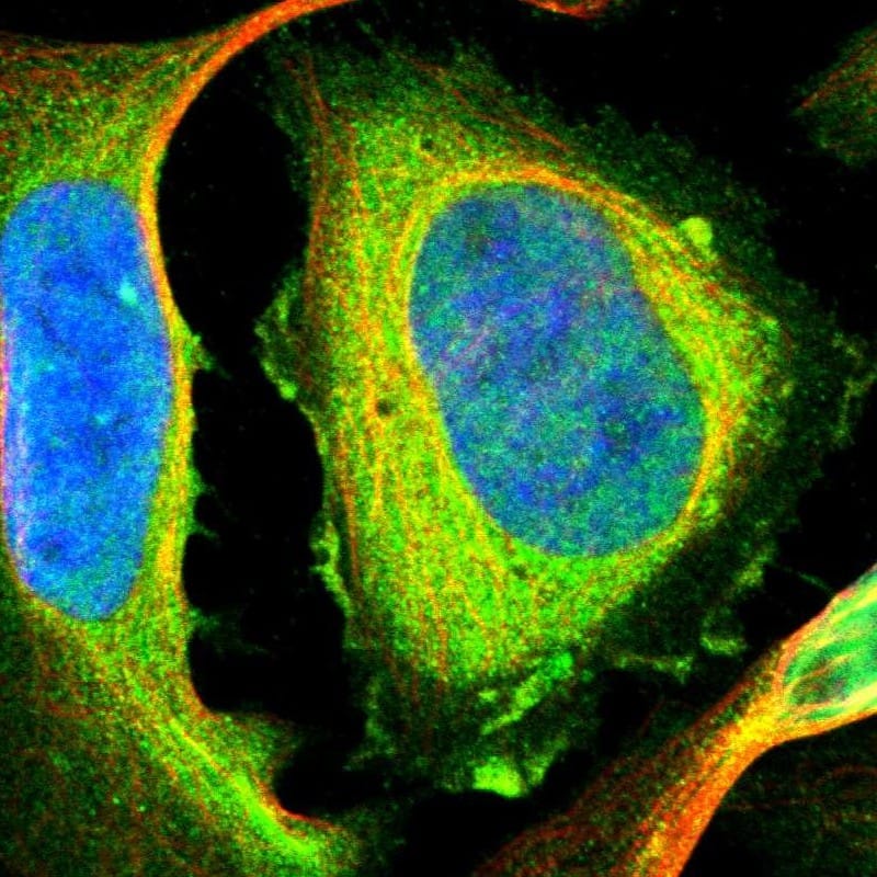 Staining of human cell line U-2 OS shows localization to plasma membrane & cytosol.