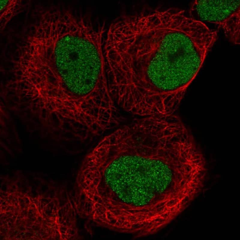 Staining of human cell line A-431 shows localization to nucleoplasm & nuclear bodies.