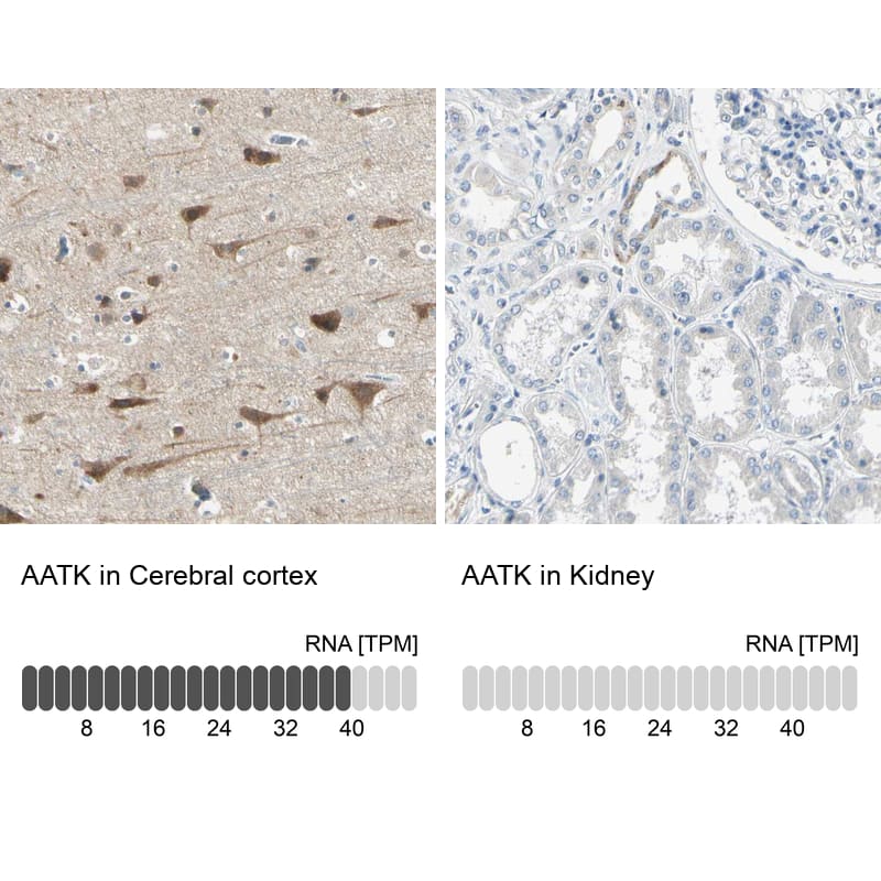 <b>Orthogonal Strategies Validation. </b>Analysis in human cerebral cortex and kidney tissues.