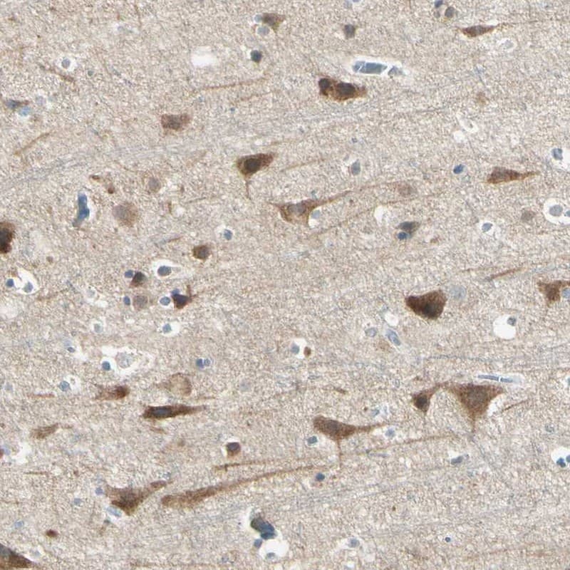 Staining of human cerebral cortex shows high expression.