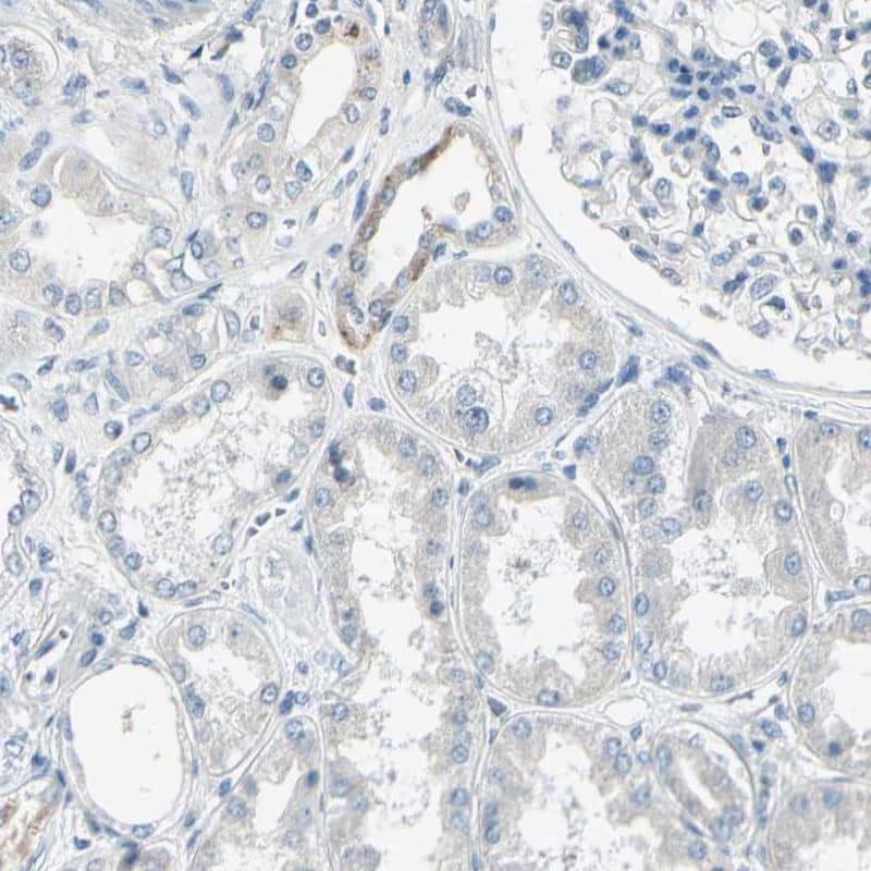Staining of human kidney shows low expression as expected.