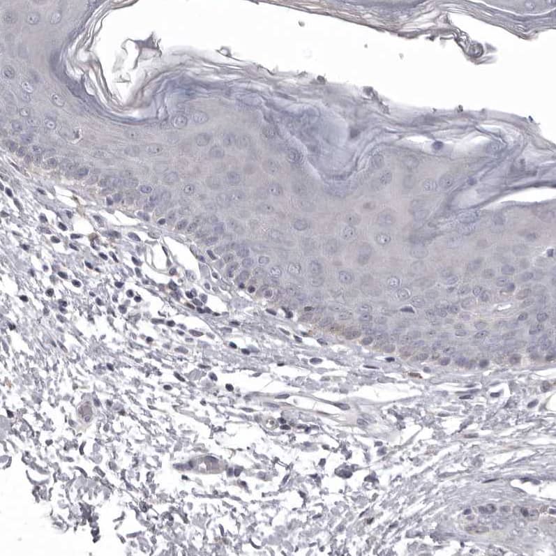 Staining of human skin shows no positivity in squamous epithelial cells as expected.